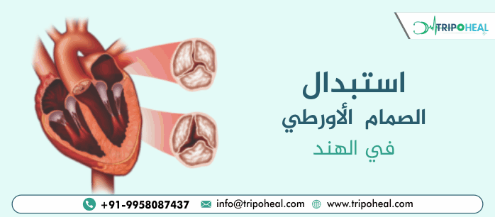 استبدال الصمام الأورطي في الهند