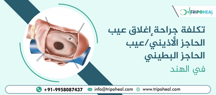 عيب الحاجز الأذيني (ASD) عيب الحاجز البطيني (VSD) في الهند