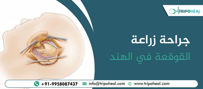 جراحة زراعة القوقعة في الهند