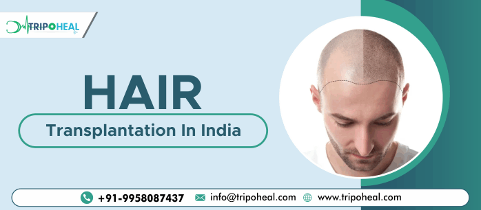 زراعة الشعر في الهند