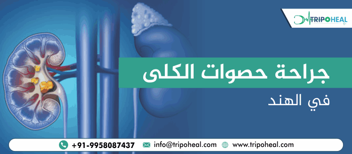 جراحة حصوات الكلى في الهند