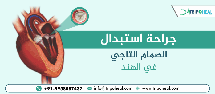 جراحة استبدال الصمام التاجي في الهند