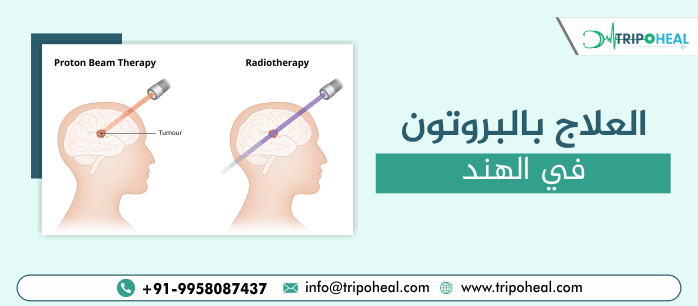 العلاج بالبروتون في الهند