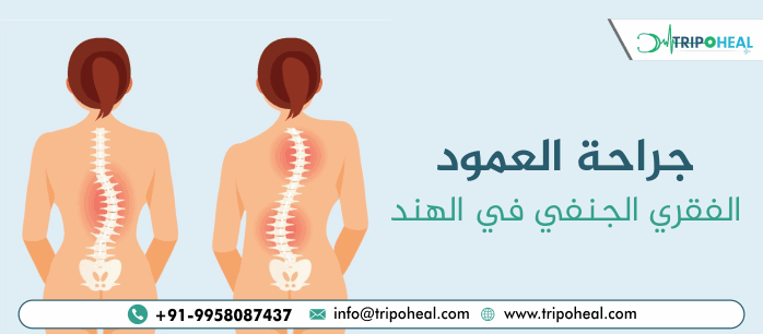 جراحة العمود الفقري الجنفي في الهند