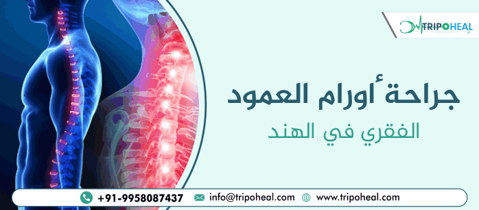 جراحة أورام العمود الفقري في الهند