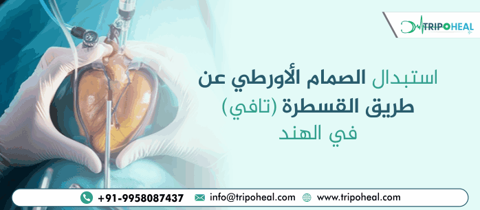 استبدال الصمام الأورطي عن طريق القسطرة (TAVR) في الهند