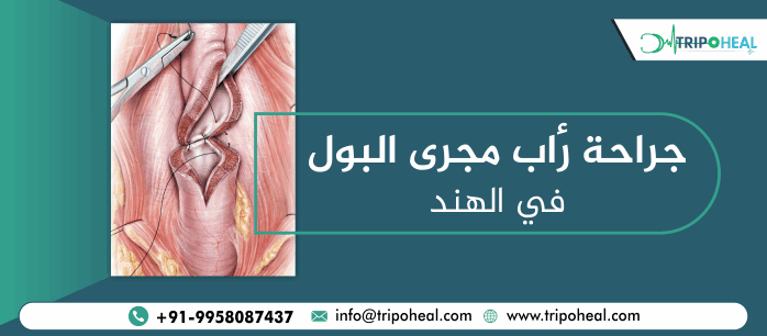 جراحة رأب مجرى البول في الهند